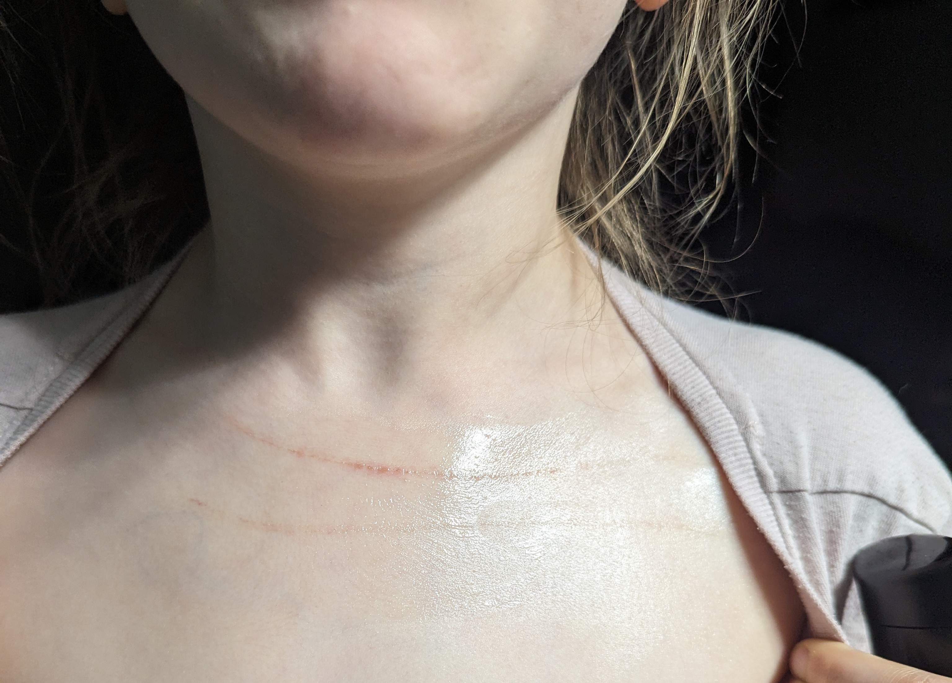 A real photo of Suture Renewal Ointment - Glass Jar by Great healing Properties  (1)